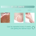 Coconut Exfoliating Foot Mask Peeling Foot Mask Soften Dry Rough Heels Coconut Exfoliating Foot Mask Peeling Foot Mask Soften Dry Rough Heels
